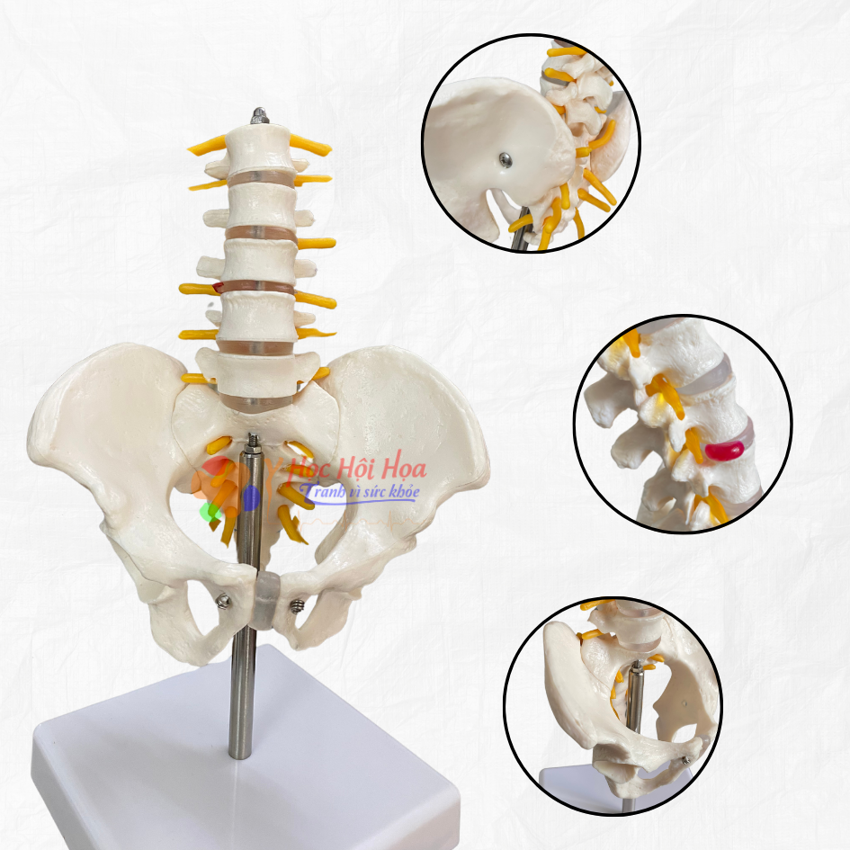 mo-hinh-cot-song-that-lung-mo-hinh-xuong-cot-song (4)